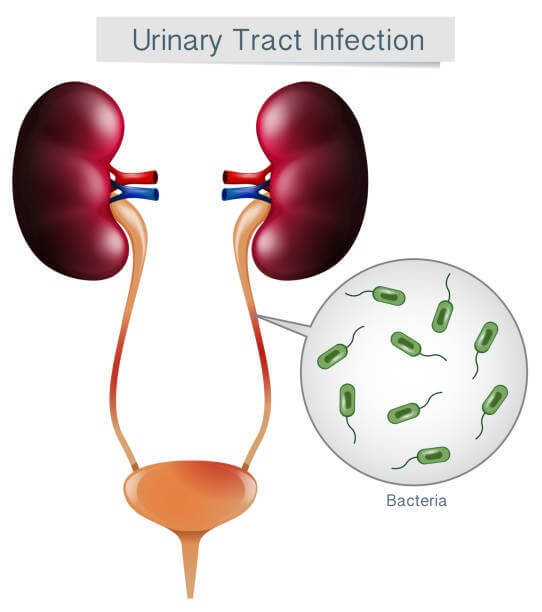 Can I Use Baking Soda for UTI treatment? Is it Safe? Bodywise